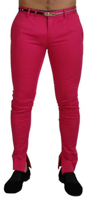 Rosa Reißverschluss Schnalle Taille Hose
