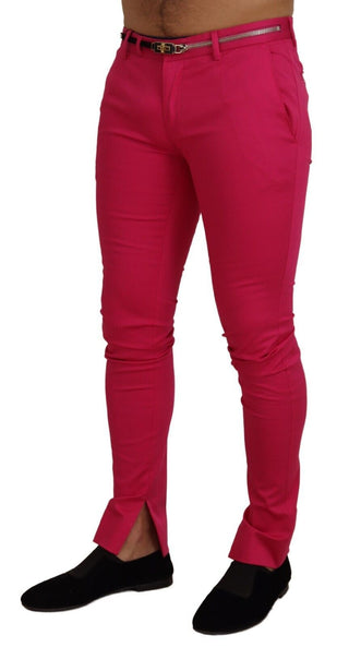 Rosa Reißverschluss Schnalle Taille Hose