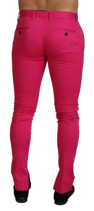 Rosa Reißverschluss Schnalle Taille Hose