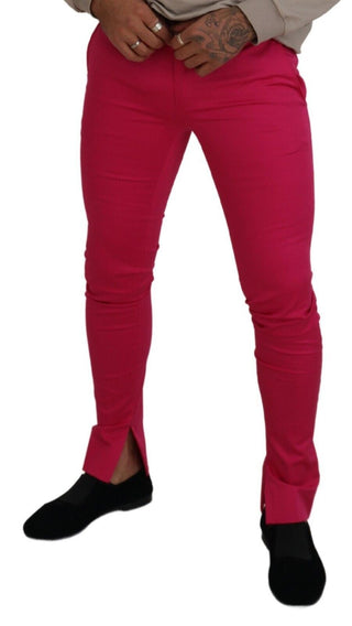 Rosa Reißverschluss Schnalle Taille Hose